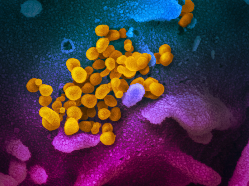 novel-coronavirus-sars-cov-2_49531042877_o-7cf68b8a7cd48d5a38e9333dcb684704cdb0ee86-s800-c85